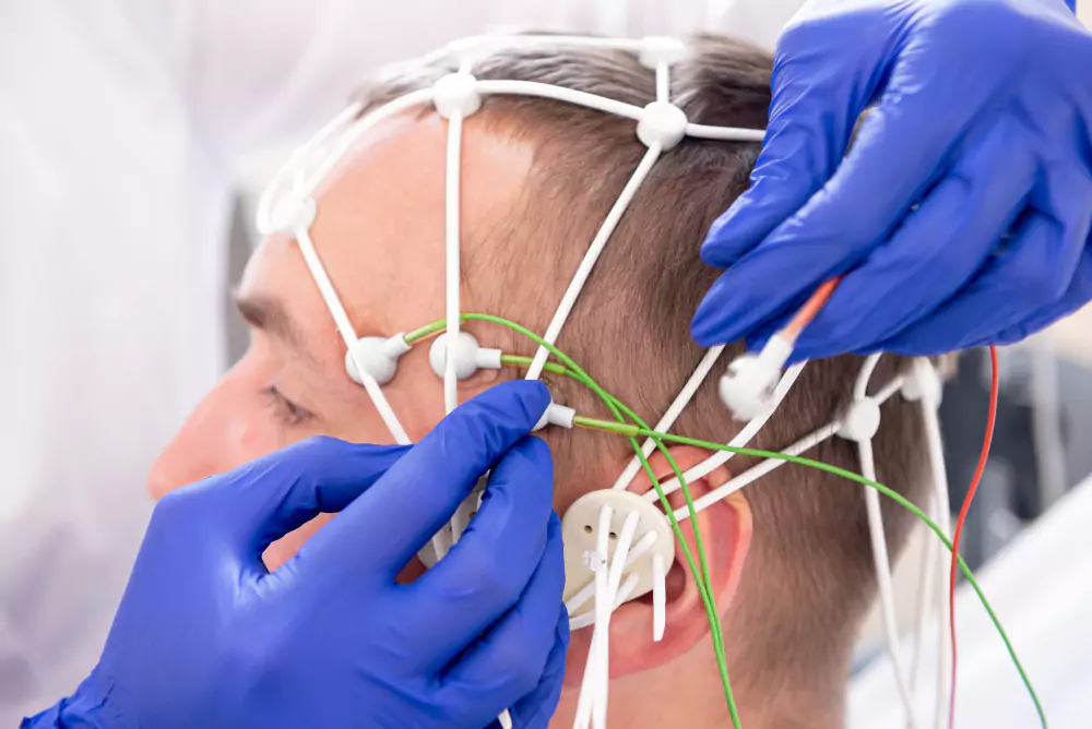 Nerve Conduction Study